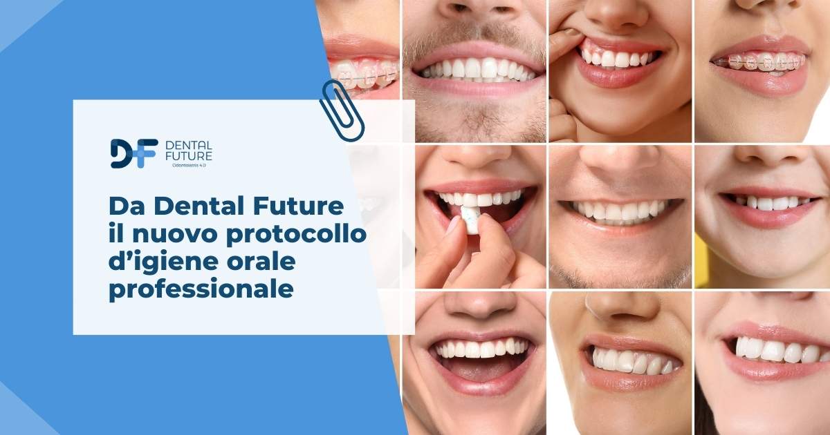 Da Dental Future il nuovo protocollo d’igiene orale professionale